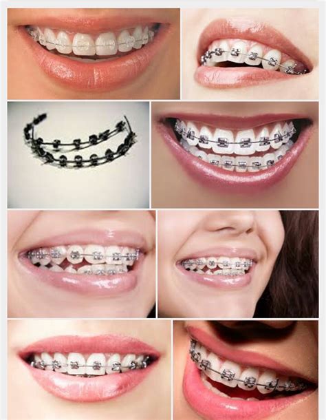 jennefer dc dental clinic|DDM Ortho Dental Clinic .